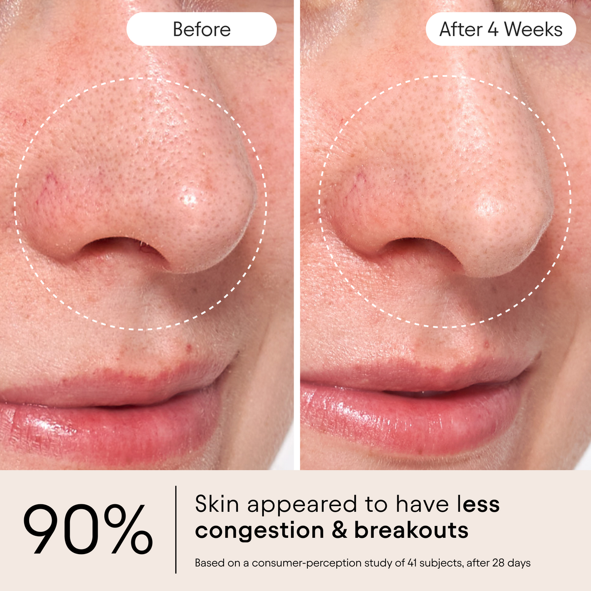 Clarifying Facial Oil