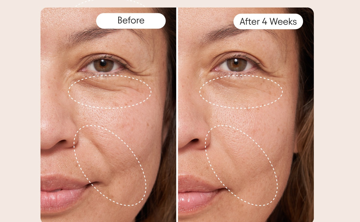 The 3 Types of Wrinkles (and How to Target Them)