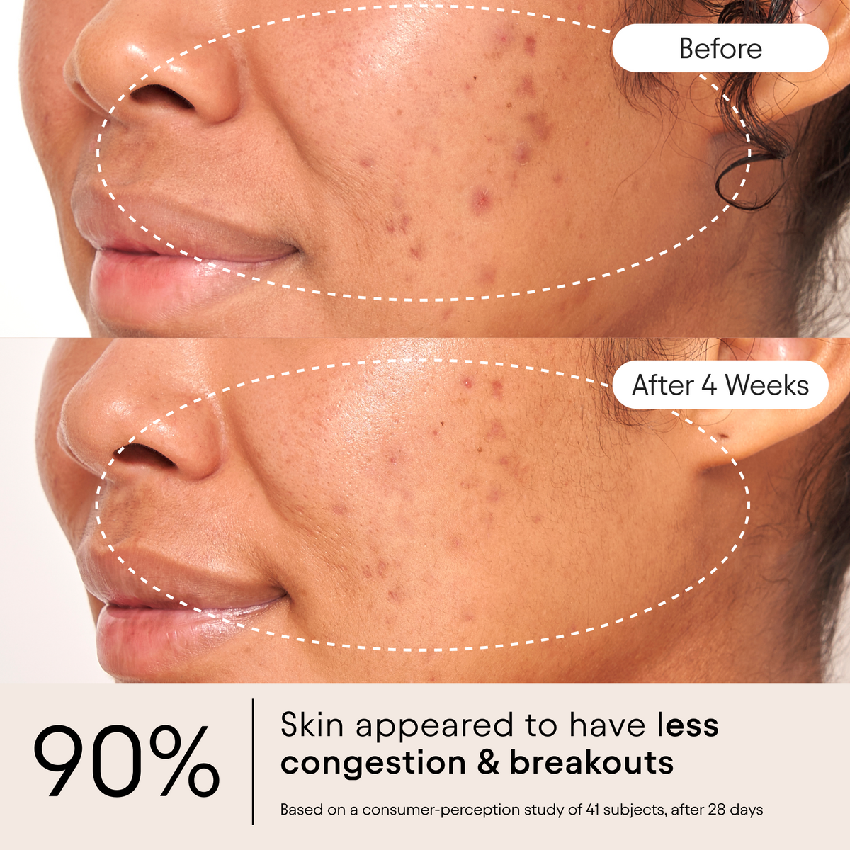 Clarifying Facial Oil