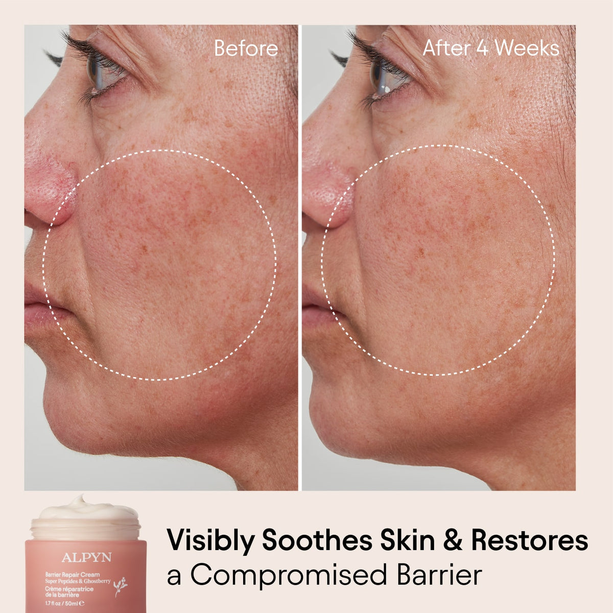 Dry & Sensitive Skin Duo (save $24)