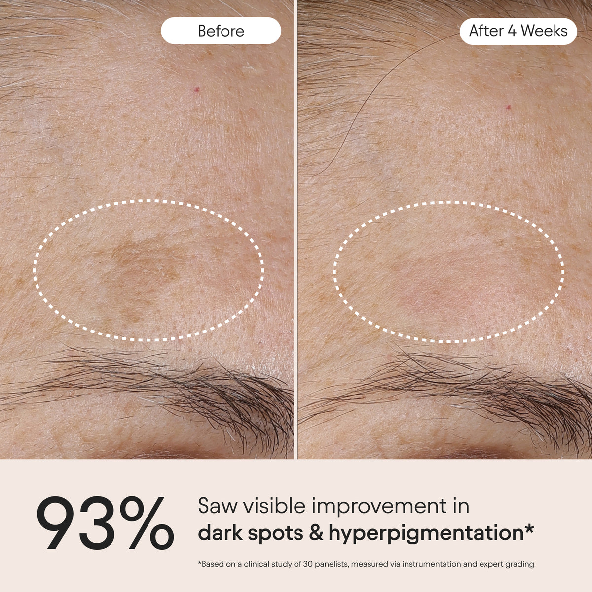 3-in-1 Barrier Repair Serum